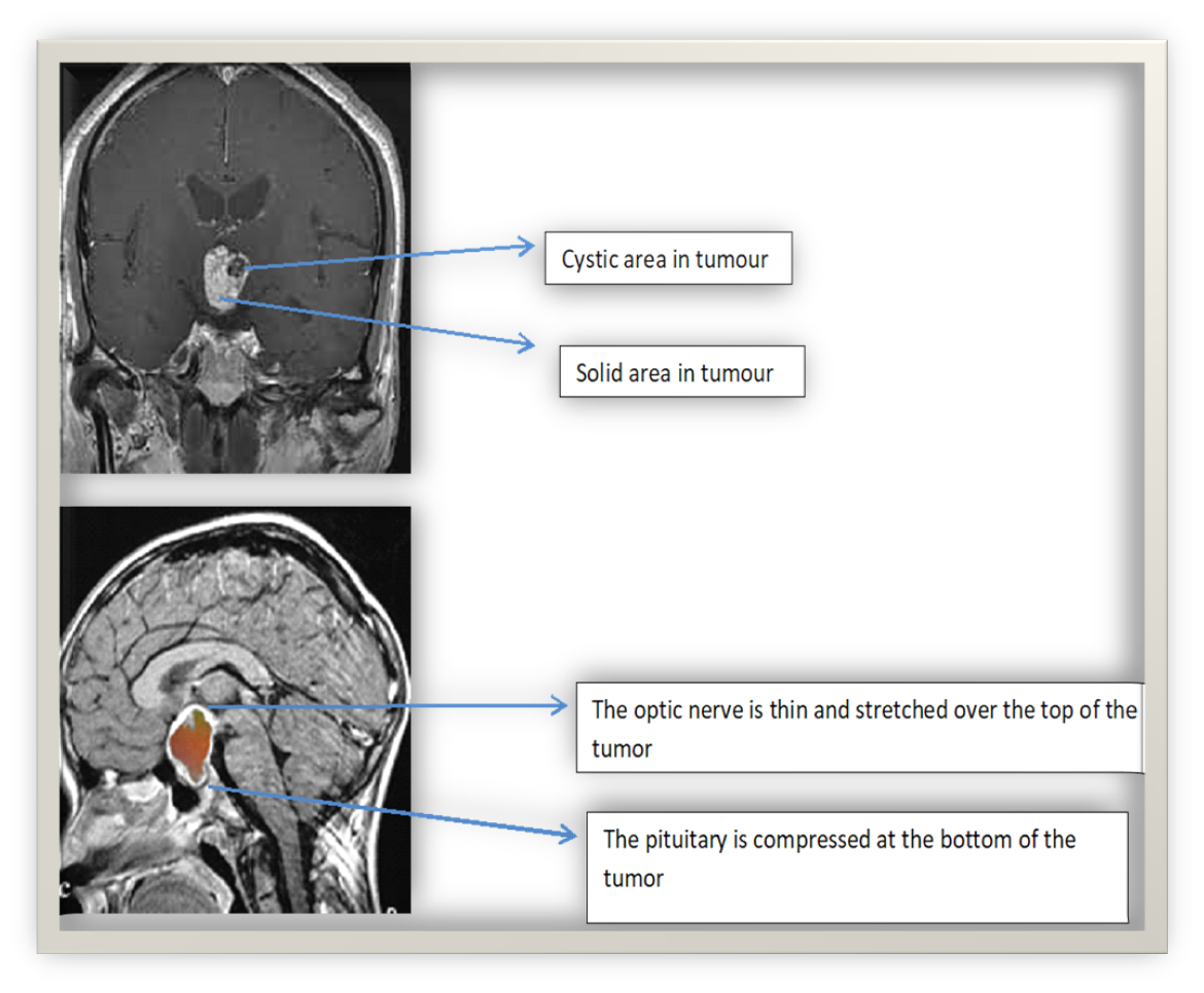 pituitary gland testing